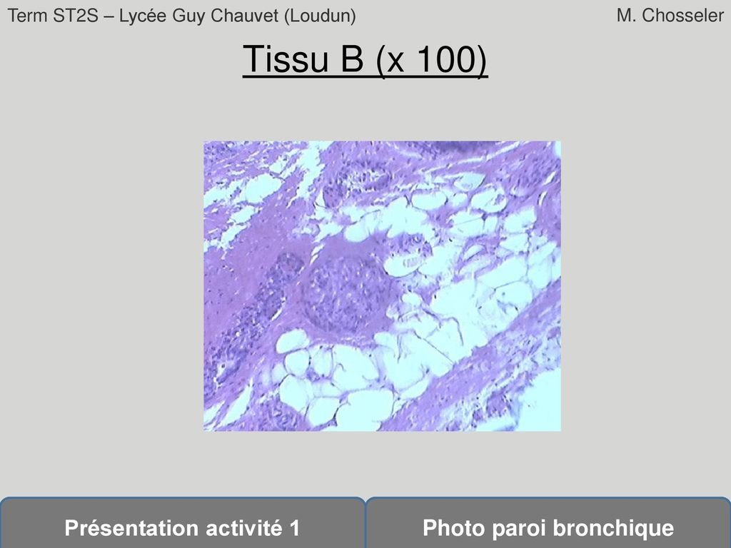 Tissu B (x 100)