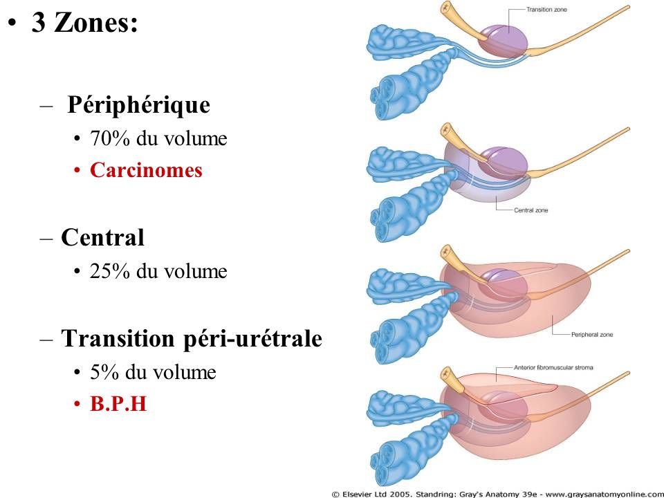 3 Zones: Périphérique Central Transition péri-urétrale 70% du volume