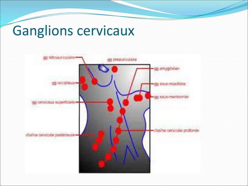 Ganglions cervicaux
