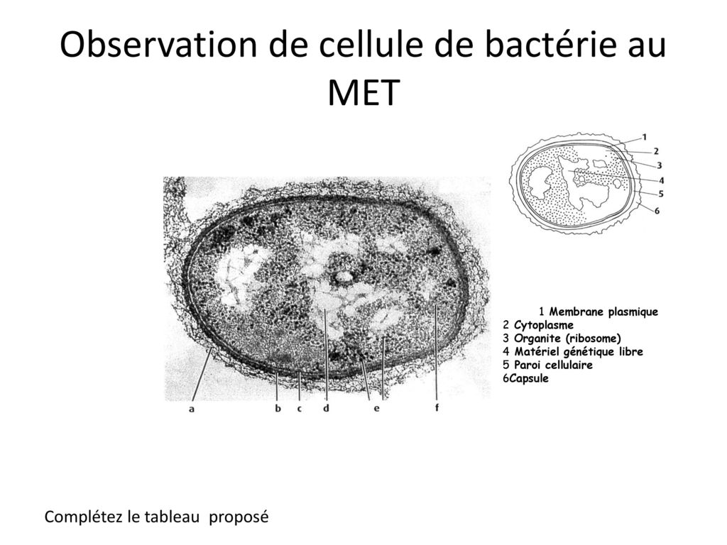 Observation de cellule de bactérie au MET