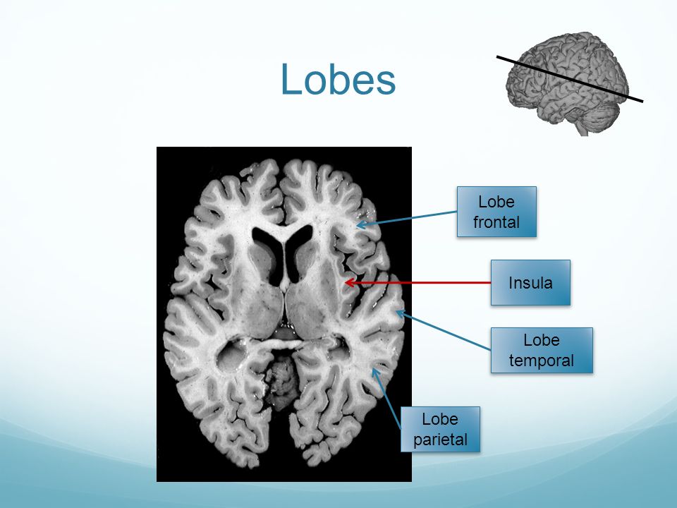 Lobes Lobe frontal Insula Lobe temporal Lobe parietal