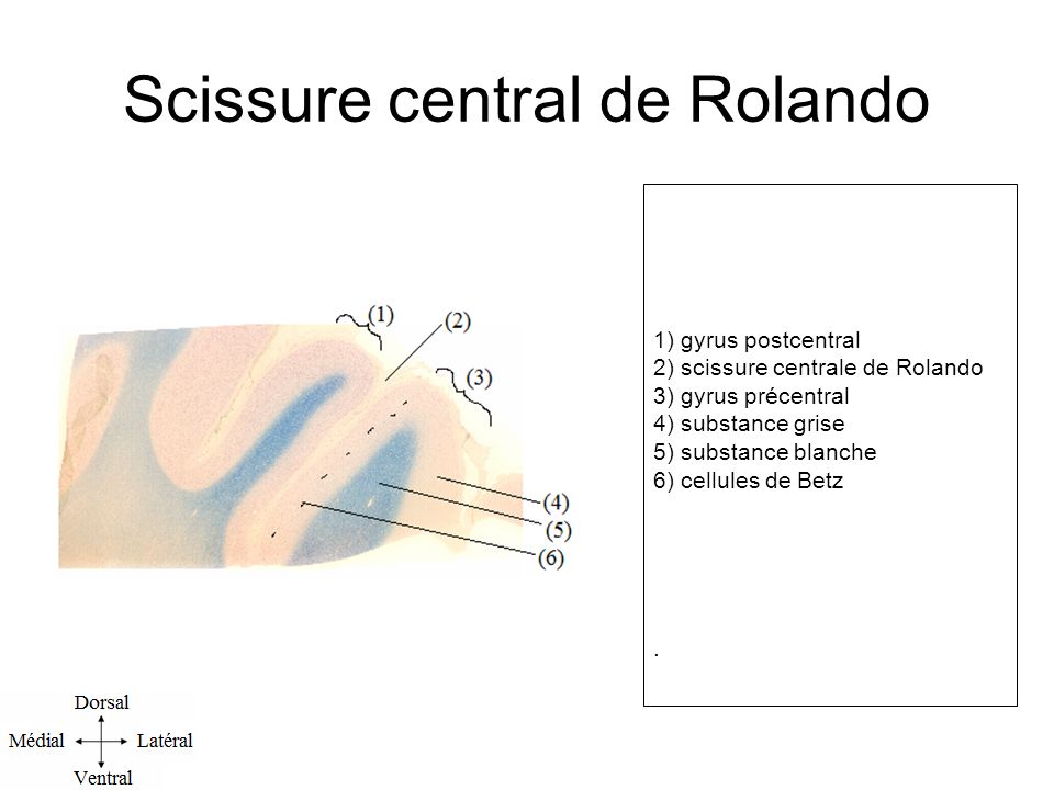Scissure central de Rolando