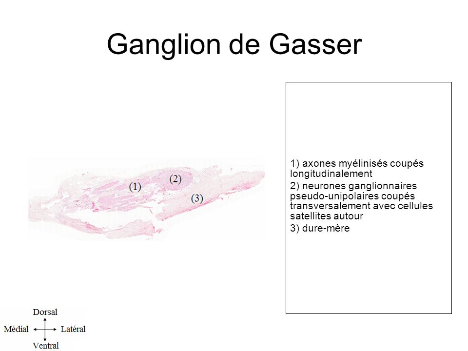 Ganglion de Gasser 1) axones myélinisés coupés longitudinalement