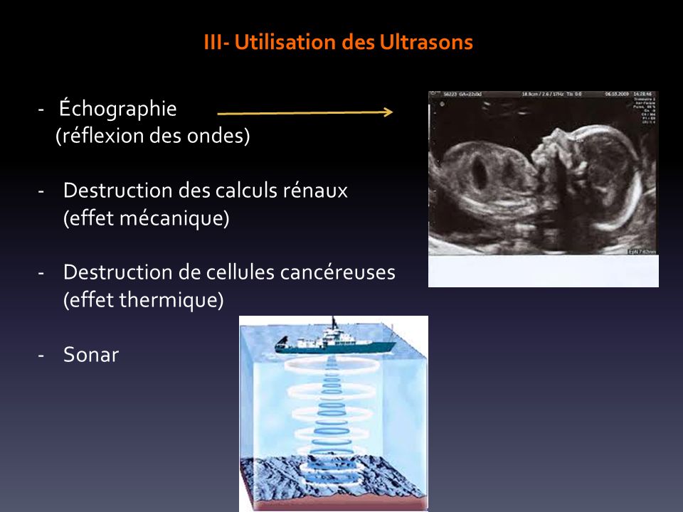 III- Utilisation des Ultrasons