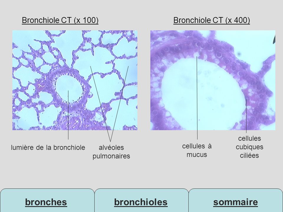 Bronchiole CT (x 100) Bronchiole CT (x 400) cellules cubiques ciliées