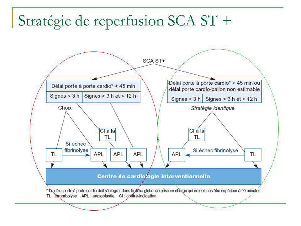 Stratégie de reperfusion SCA ST +