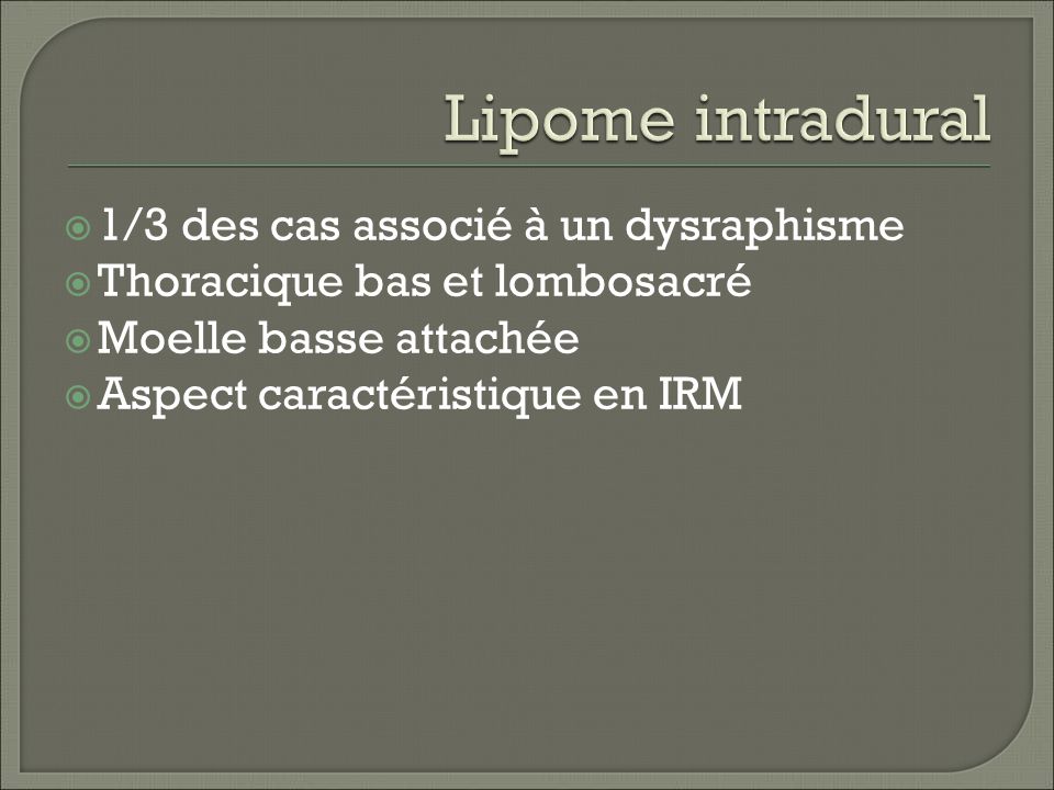 Lipome intradural 1/3 des cas associé à un dysraphisme