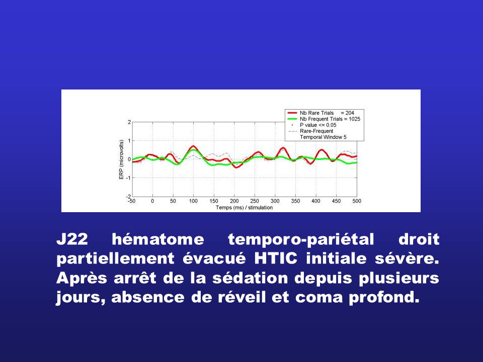 J22 hématome temporo-pariétal droit partiellement évacué HTIC initiale sévère.