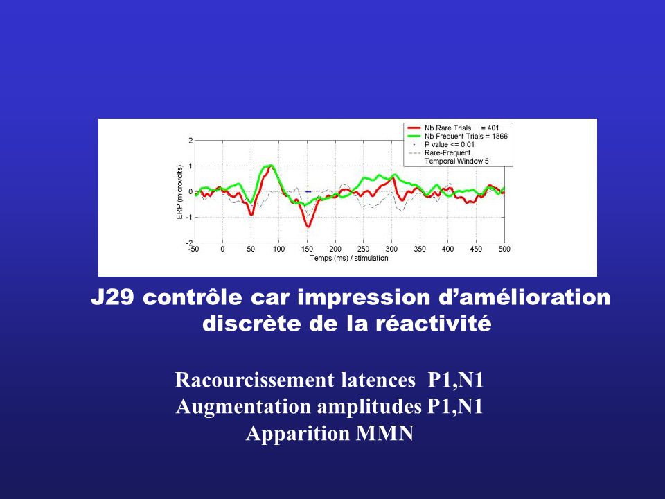 Racourcissement latences P1,N1 Augmentation amplitudes P1,N1