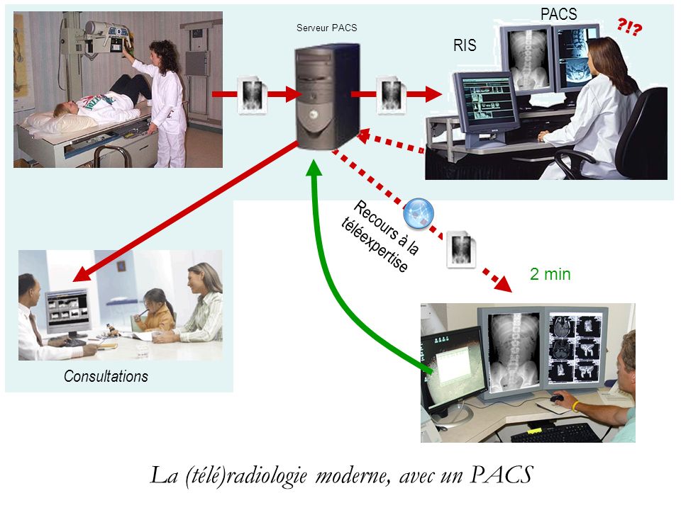 La (télé)radiologie moderne, avec un PACS