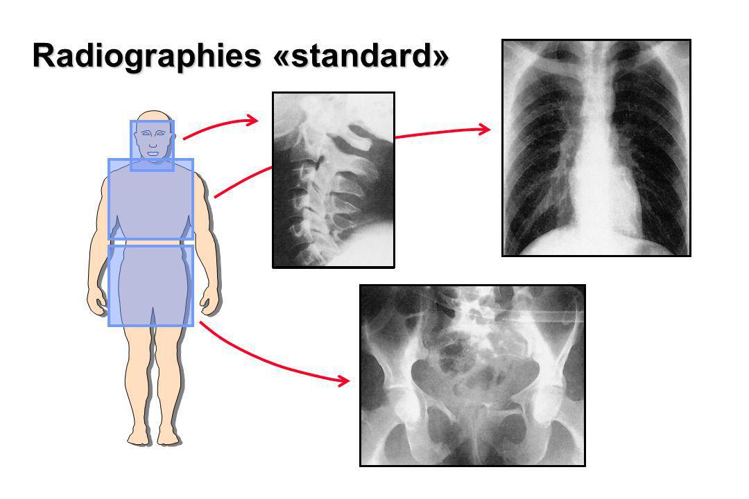 Radiographies «standard»