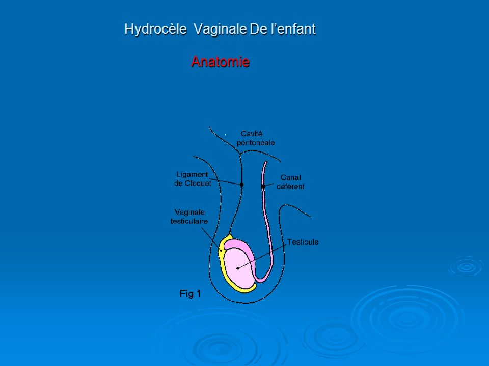 Hydrocèle Vaginale De l’enfant Anatomie
