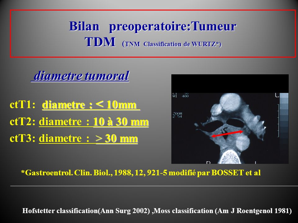 Bilan preoperatoire:Tumeur TDM (TNM Classification de WURTZ*)