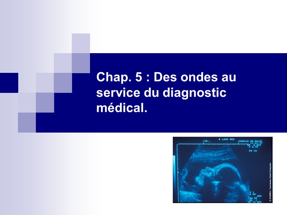 Chap. 5 : Des ondes au service du diagnostic médical.