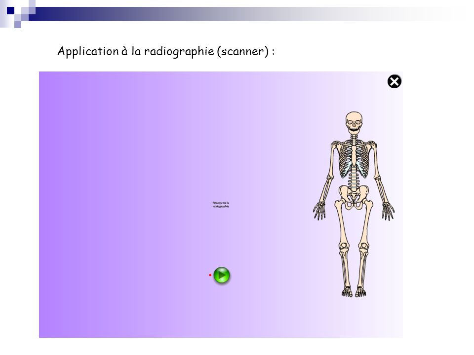 Application à la radiographie (scanner) :