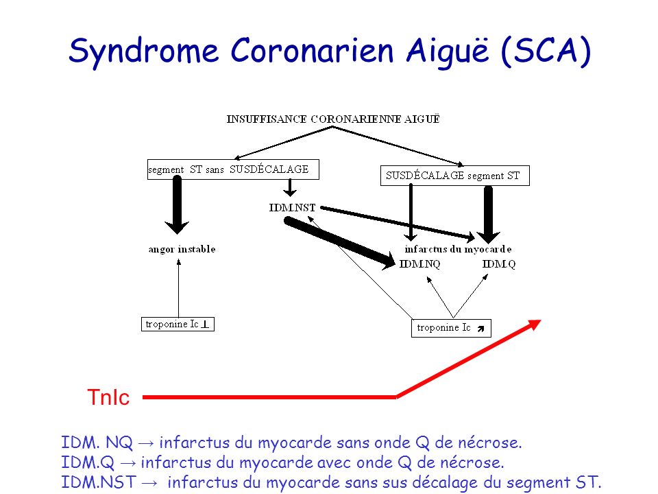 Syndrome Coronarien Aiguë (SCA)