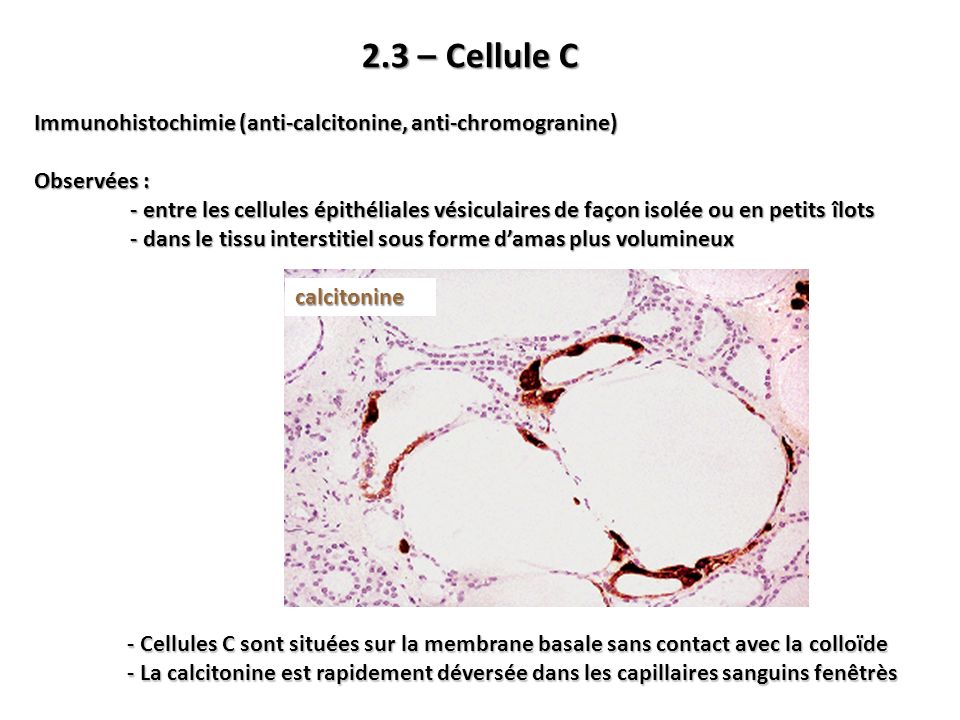 2.3 – Cellule C Immunohistochimie (anti-calcitonine, anti-chromogranine) Observées :