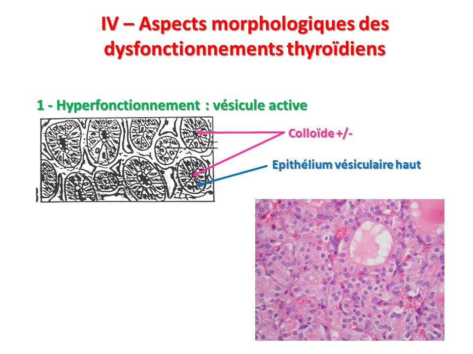IV – Aspects morphologiques des dysfonctionnements thyroïdiens