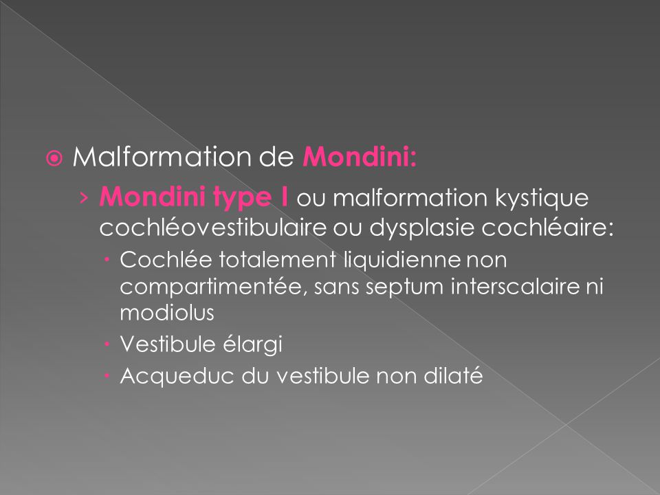 Malformation de Mondini: