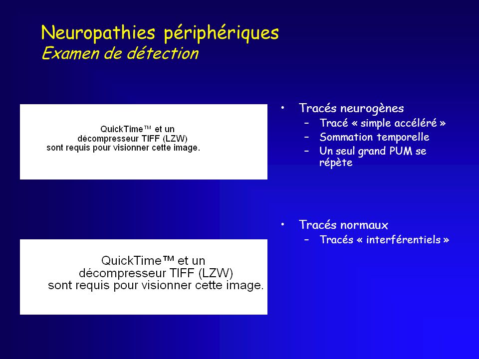 Neuropathies périphériques Examen de détection