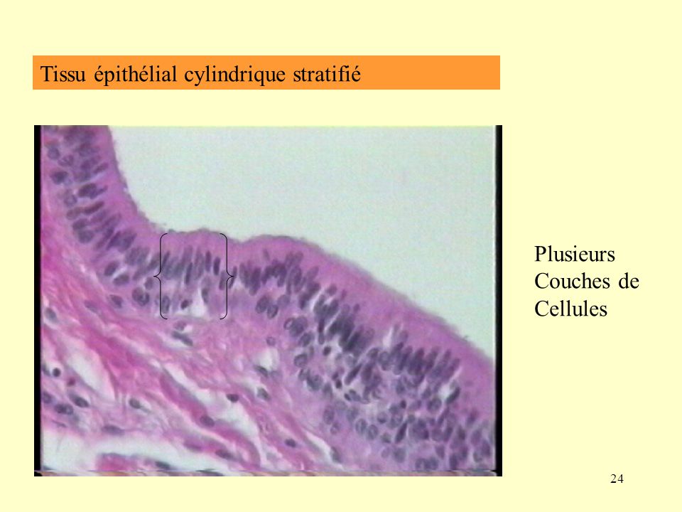 Tissu épithélial cylindrique stratifié