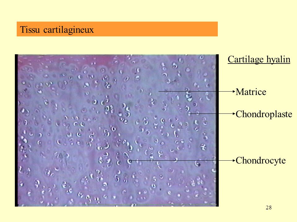 Tissu cartilagineux Cartilage hyalin Matrice Chondroplaste Chondrocyte