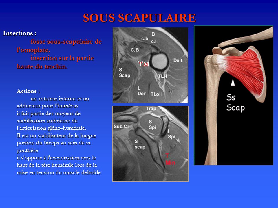 SOUS SCAPULAIRE Insertions : fosse sous-scapulaire de l omoplate.