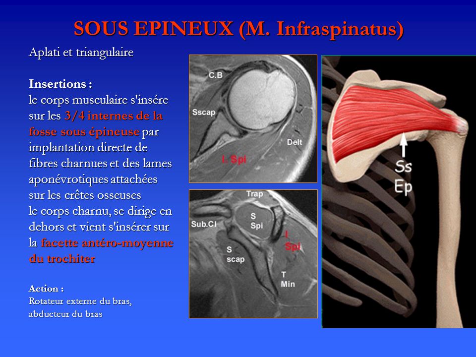 SOUS EPINEUX (M. Infraspinatus)