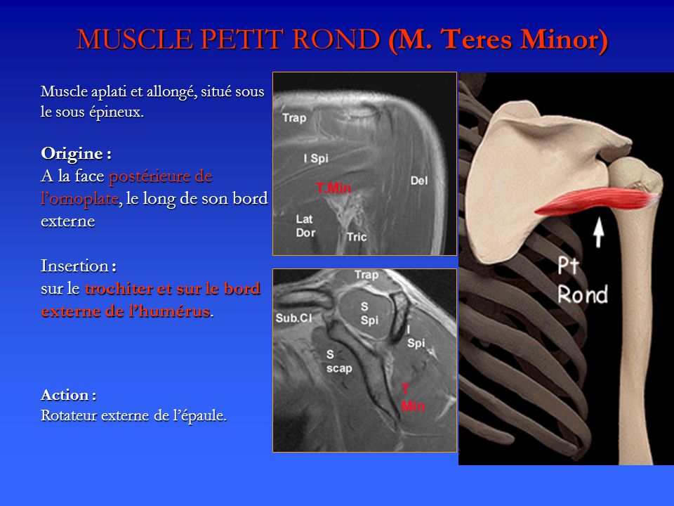 MUSCLE PETIT ROND (M. Teres Minor)