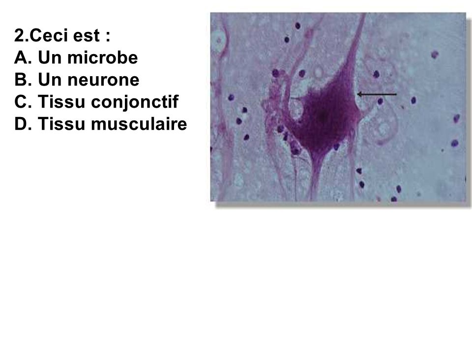 2. Ceci est : A. Un microbe B. Un neurone C. Tissu conjonctif D