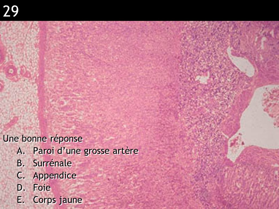 Réponse CDE (adipocyte)