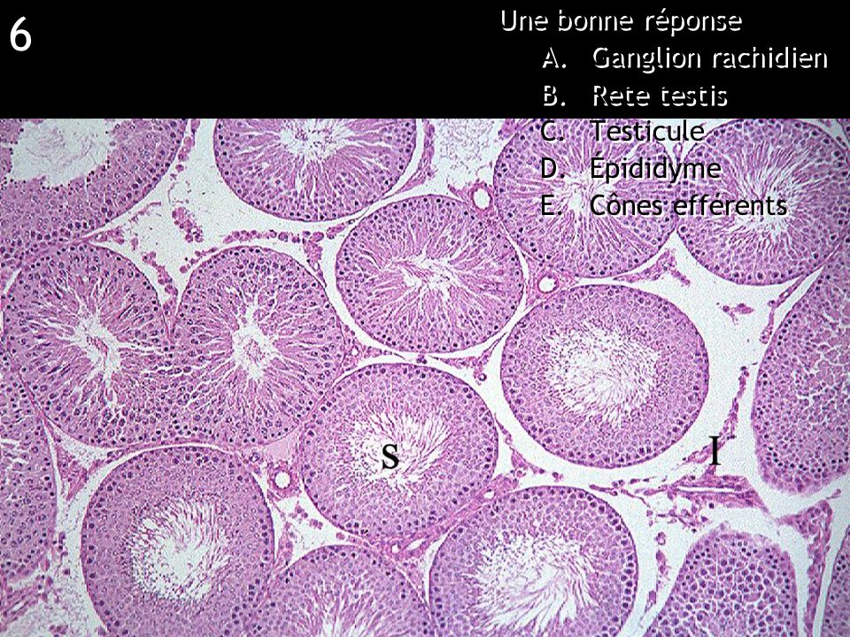 Réponse E (appendice) Une bonne réponse Amygdale Grêle Utérus Colon