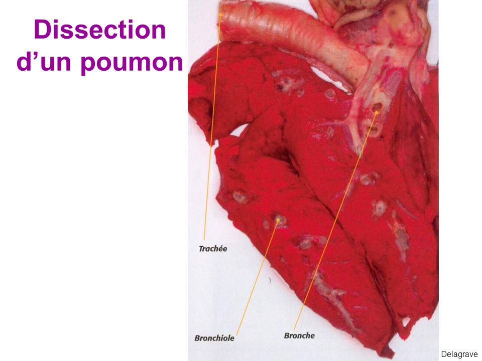 Dissection d’un poumon