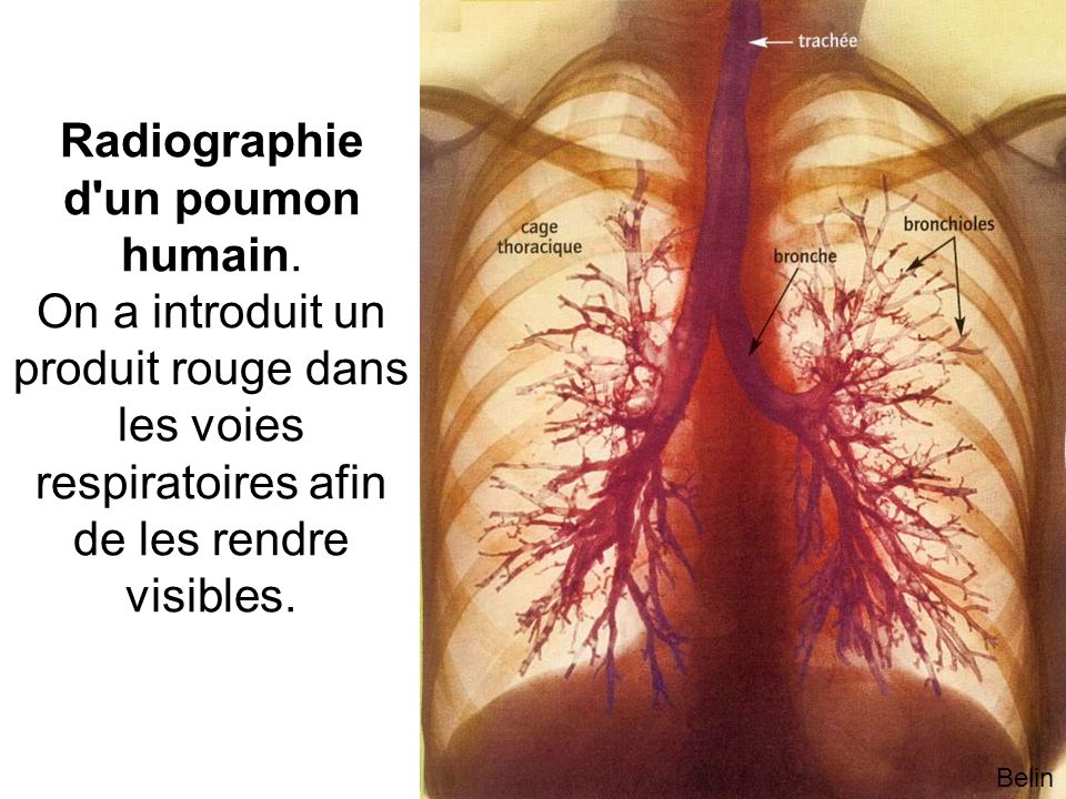 Radiographie d un poumon humain.