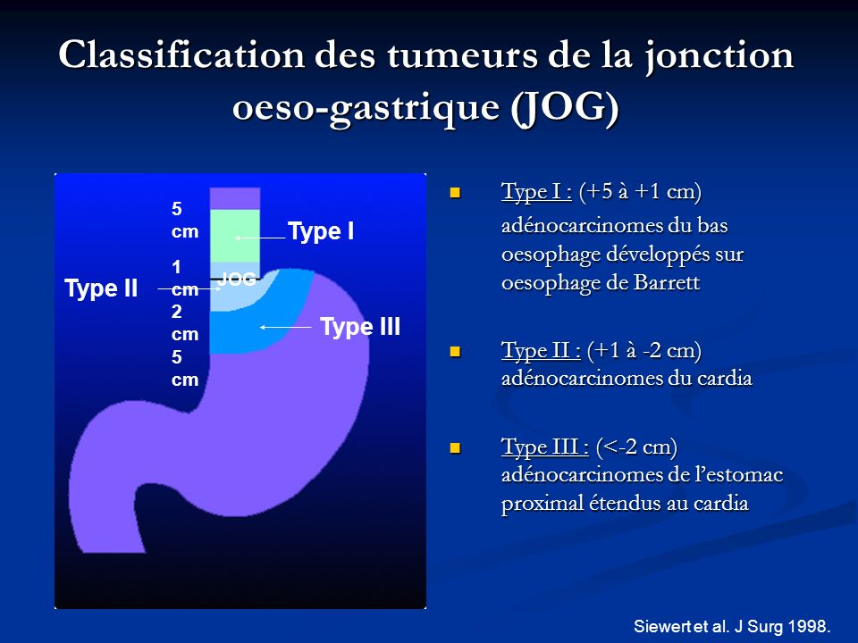 Classification des tumeurs de la jonction oeso-gastrique (JOG)