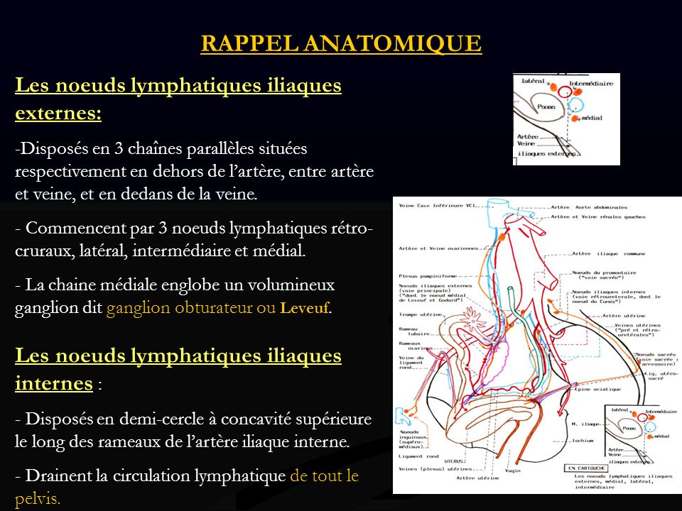 RAPPEL ANATOMIQUE Les noeuds lymphatiques iliaques externes: