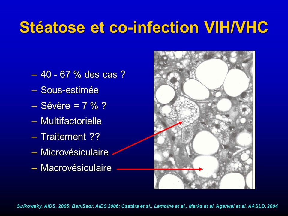 Stéatose et co-infection VIH/VHC