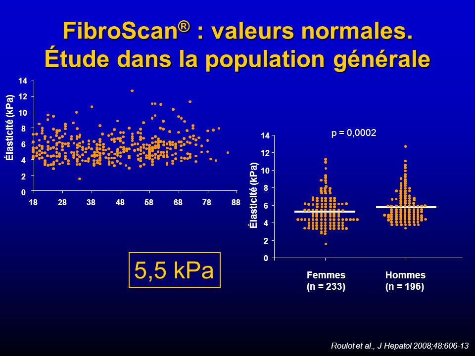 FibroScan® : valeurs normales. Étude dans la population générale