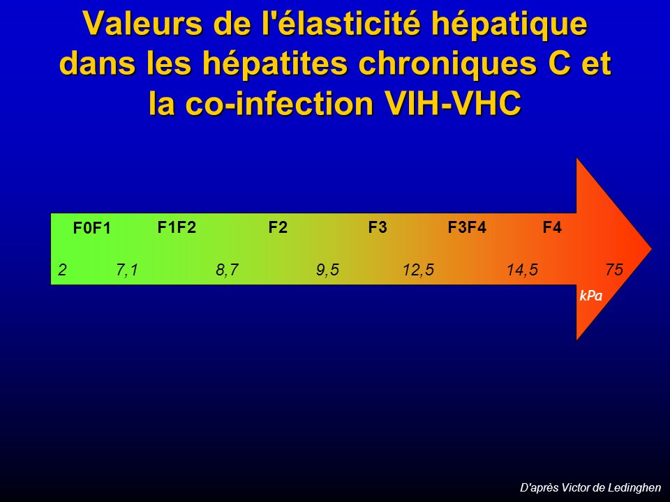 Valeurs de l élasticité hépatique dans les hépatites chroniques C et la co-infection VIH-VHC