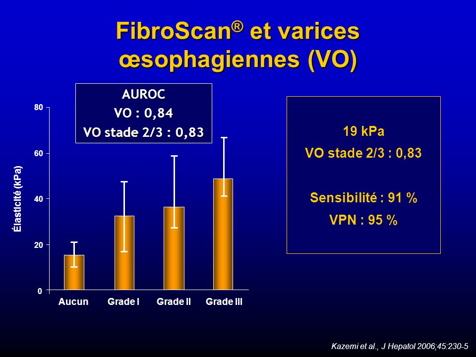 FibroScan® et varices œsophagiennes (VO)