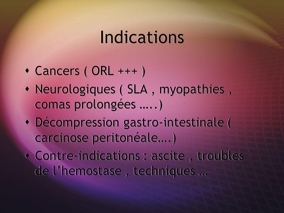 Indications Cancers ( ORL +++ )