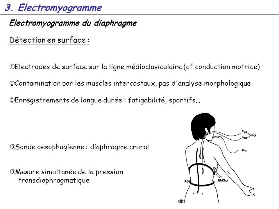 3. Electromyogramme Electromyogramme du diaphragme