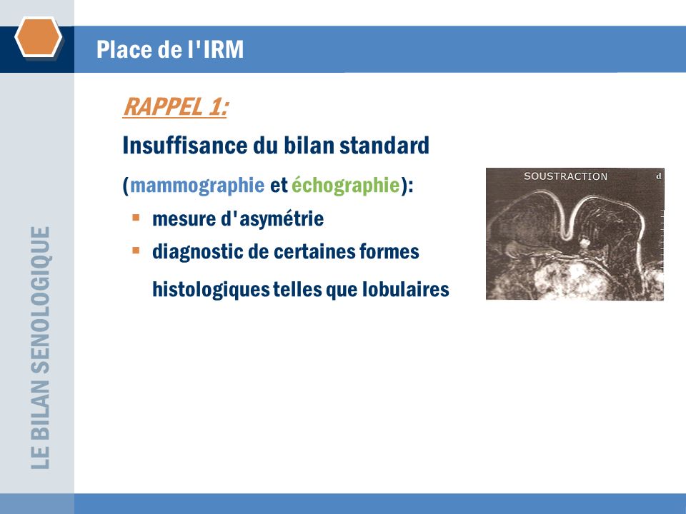 Insuffisance du bilan standard (mammographie et échographie):
