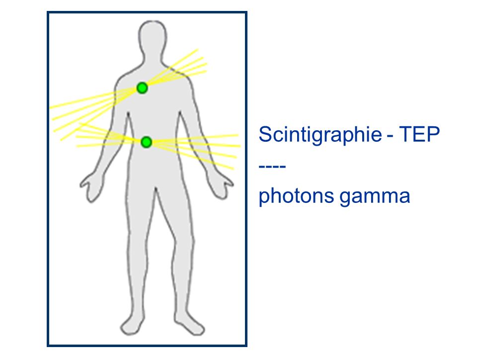 Scintigraphie - TEP ---- photons gamma