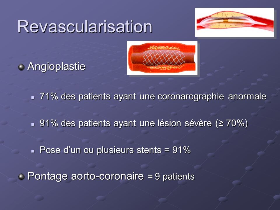 Revascularisation Angioplastie Pontage aorto-coronaire = 9 patients