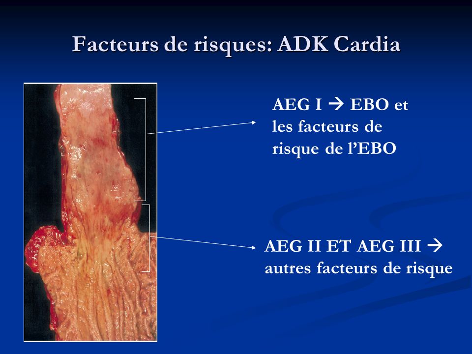 Facteurs de risques: ADK Cardia
