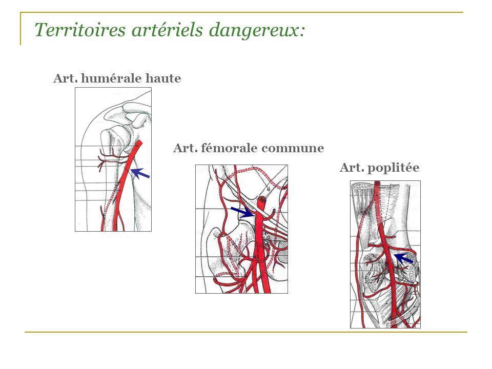 Territoires artériels dangereux: