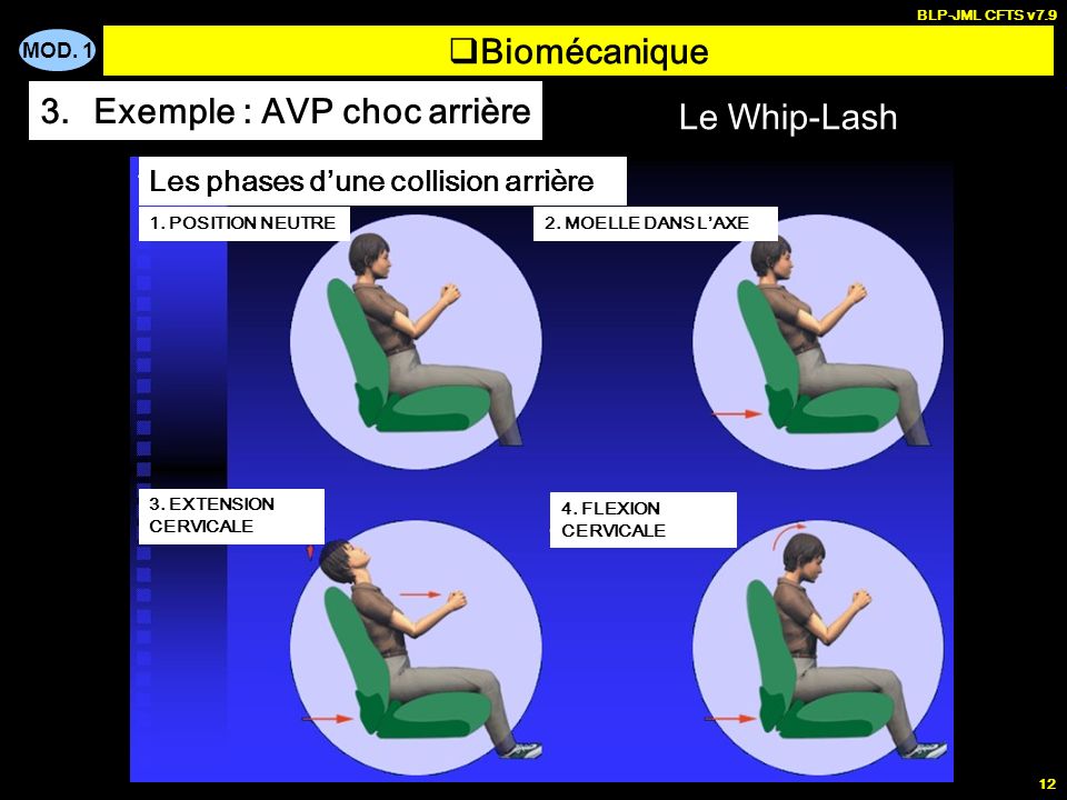 Exemple : AVP choc arrière Le Whip-Lash