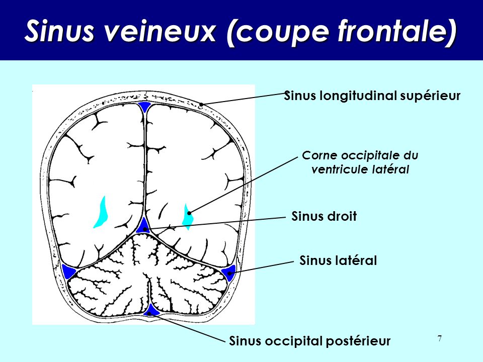 Sinus veineux (coupe frontale)