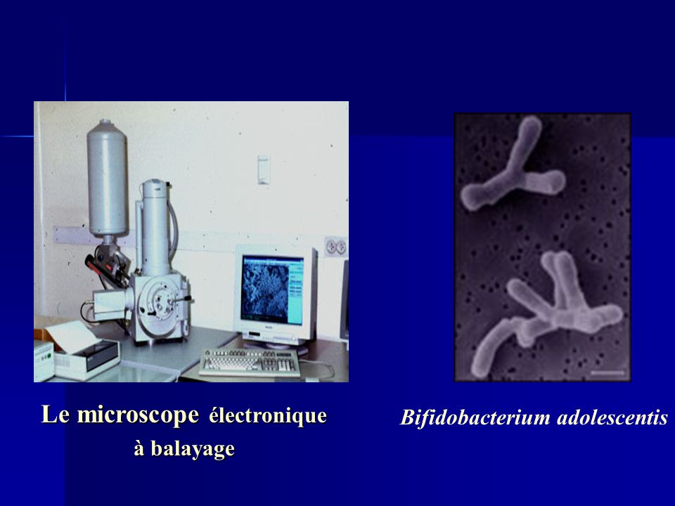 Le microscope électronique Bifidobacterium adolescentis
